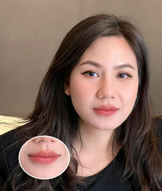 Đôi môi hồi phục tự nhiên sau một thời gian chăm sóc