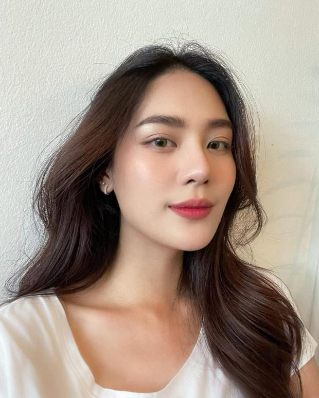Khách hàng Việt Nam với đôi môi hồi phục đẹp sau phun