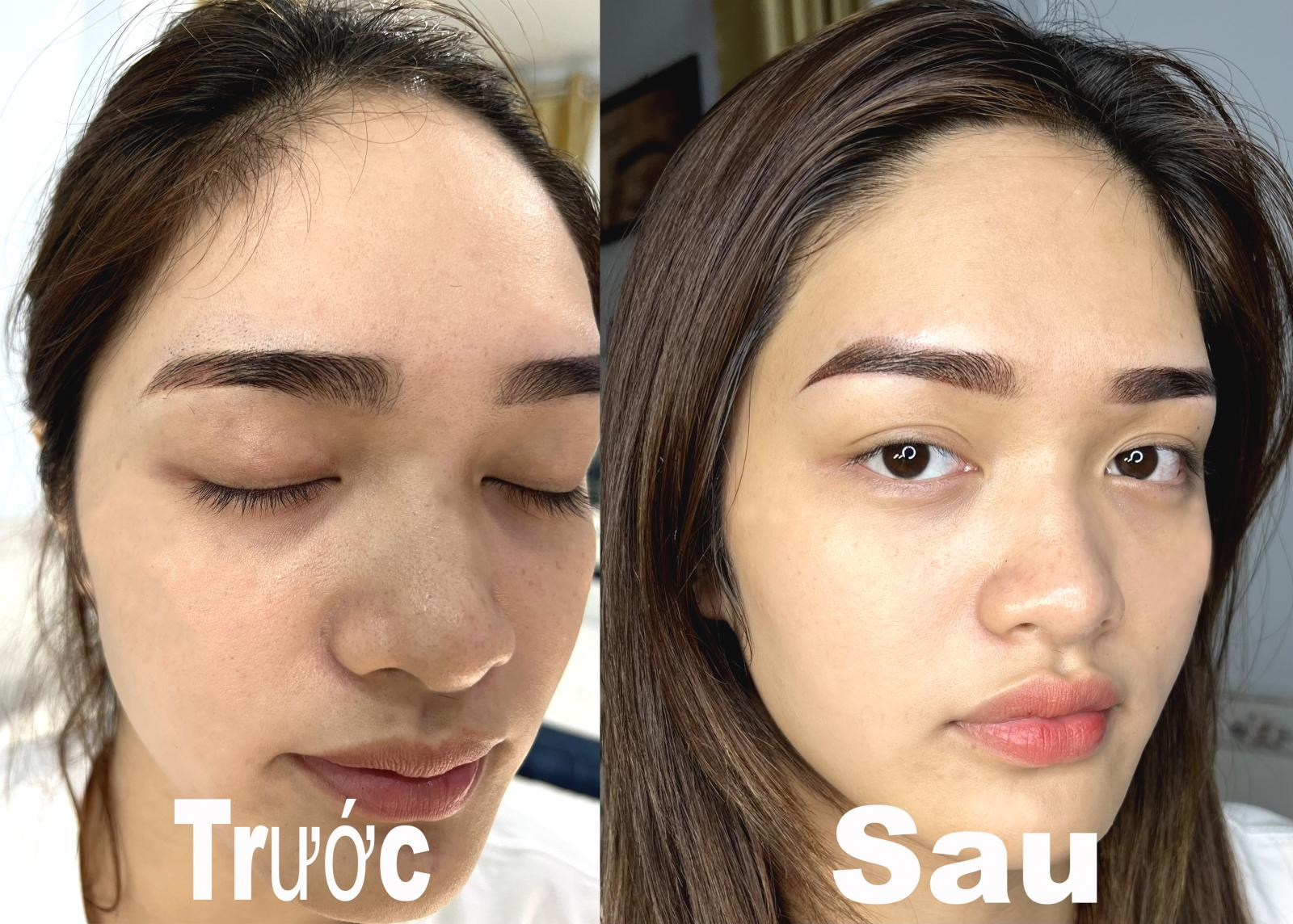 Trước và sau khi chỉnh sửa chân mày cũ