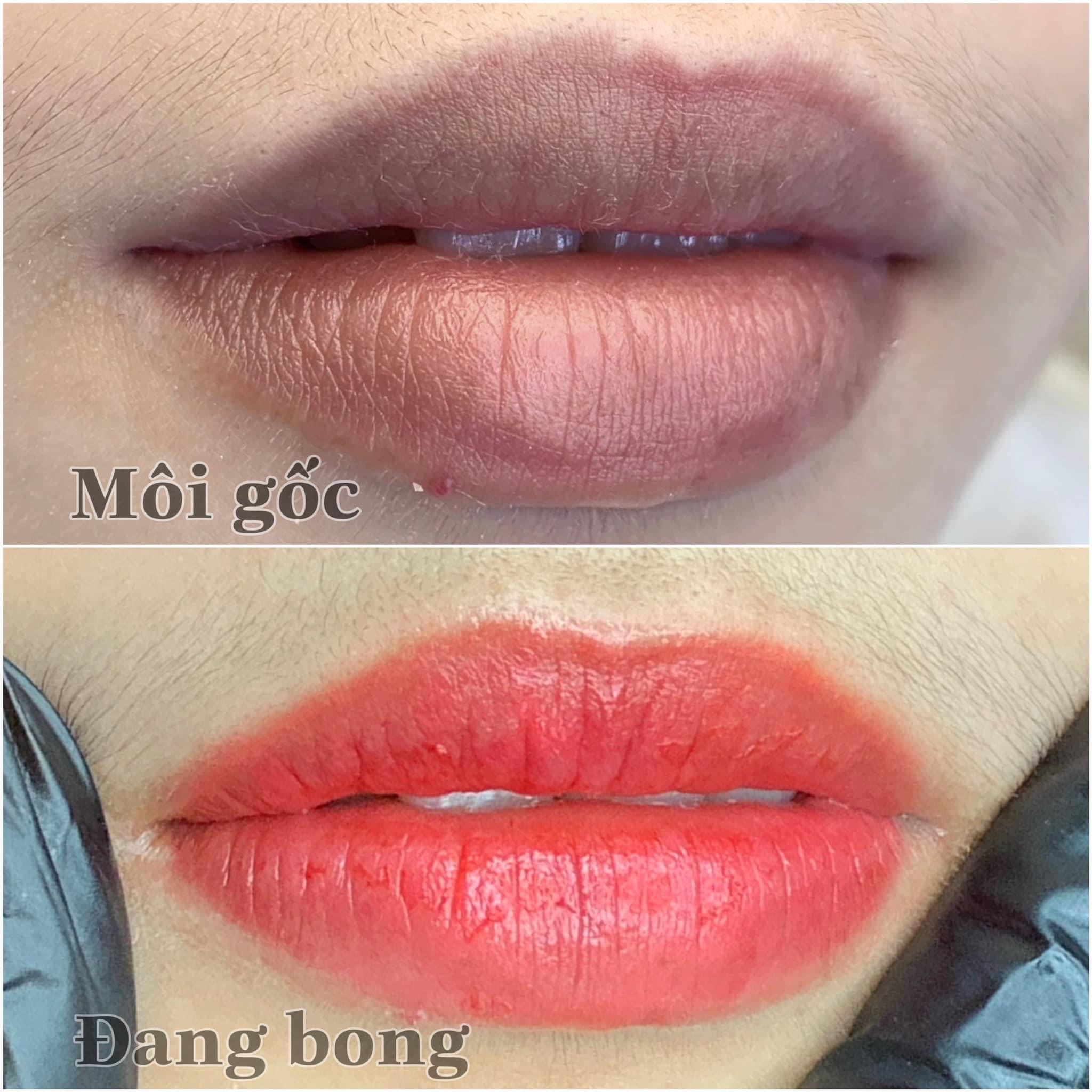 Môi gốc thâm nhẹ và môi đang bong sau phun