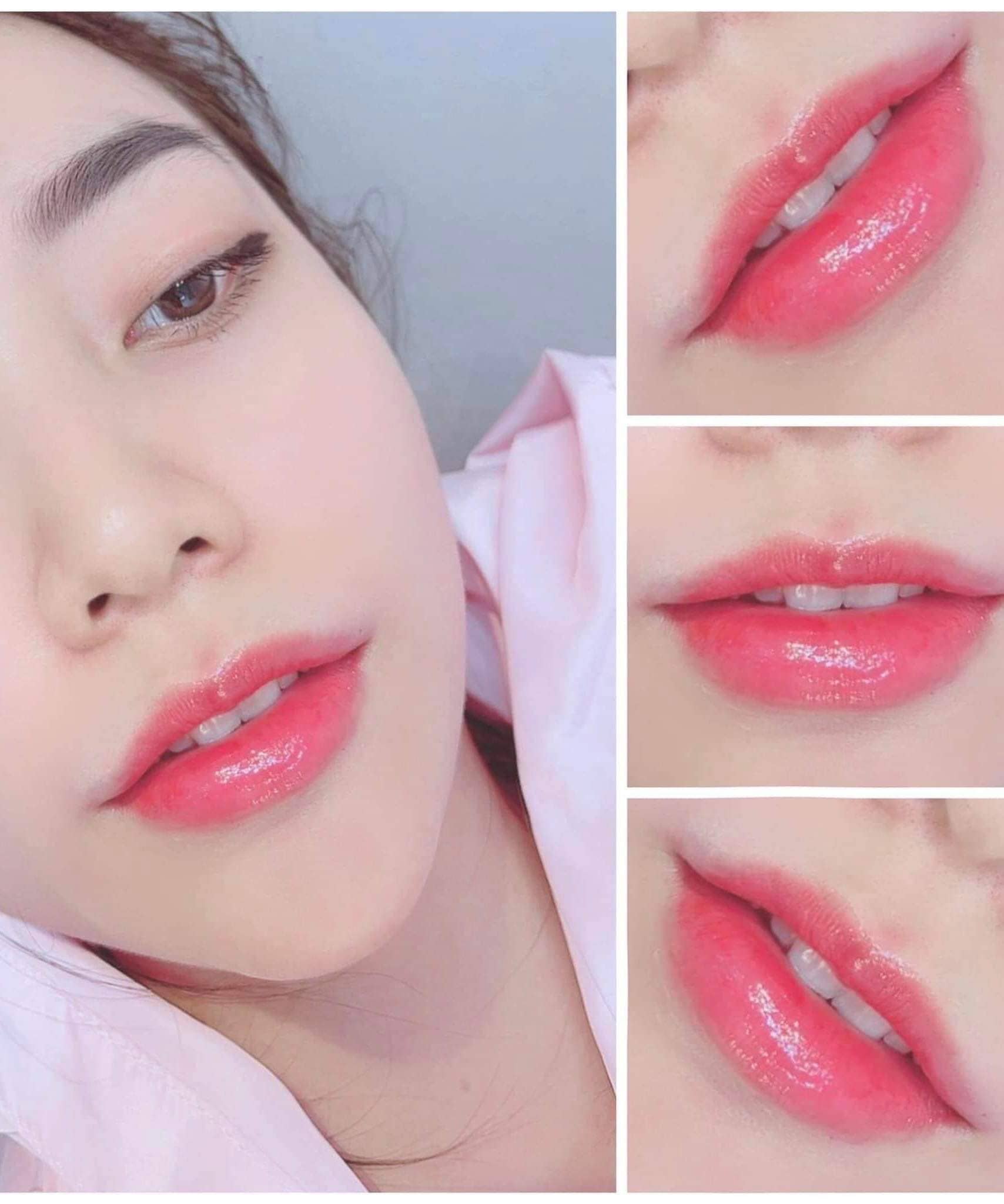 Kết quả phun môi collagen màu hồng tự nhiên
