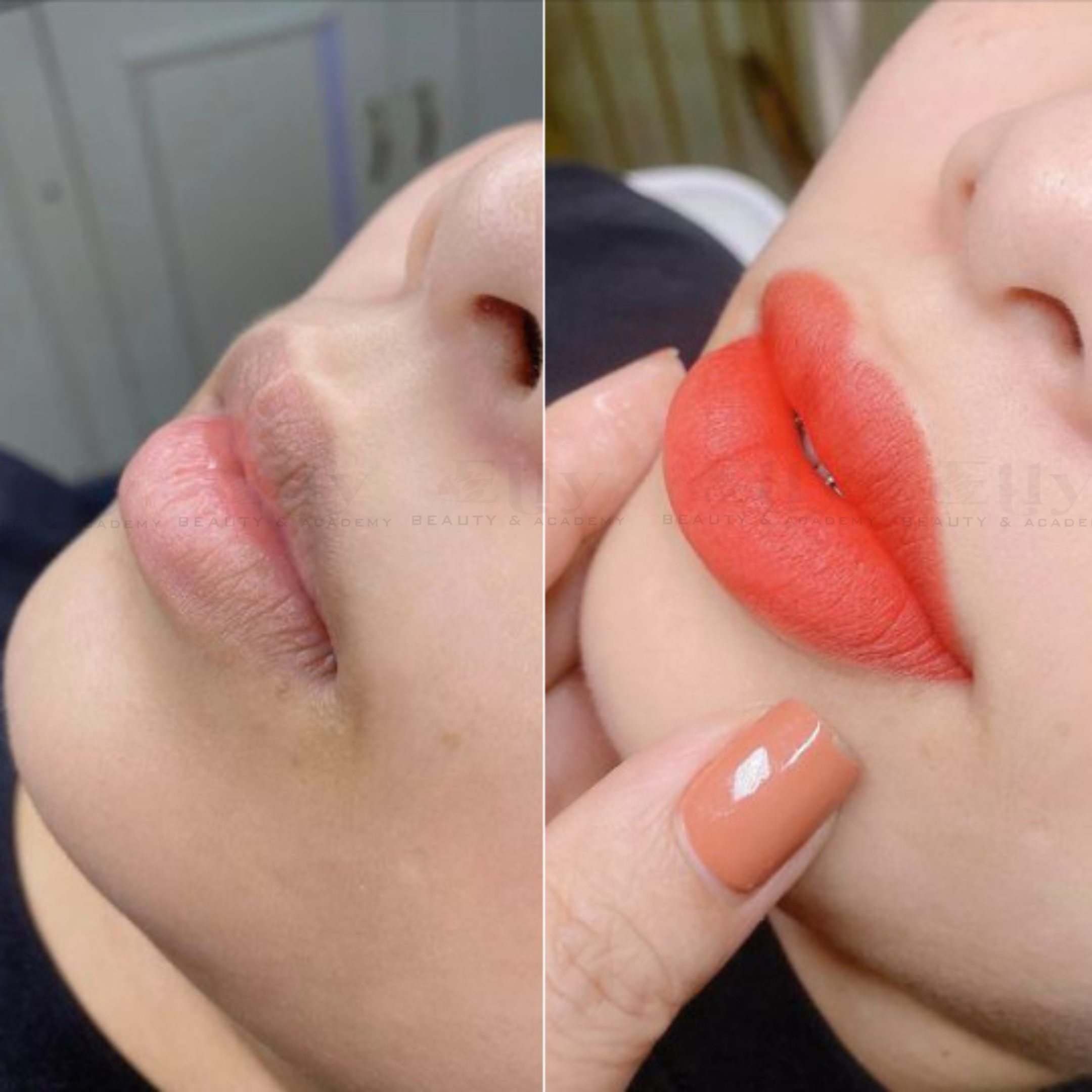 Ảnh phun môi collagen tại nhà ELLY SPA 4